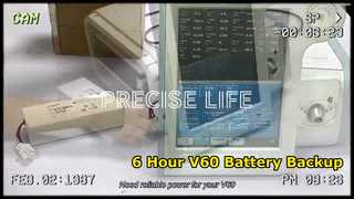 Respironics V60 Ventilatör Pili 6 Saat Çalışma Süresi